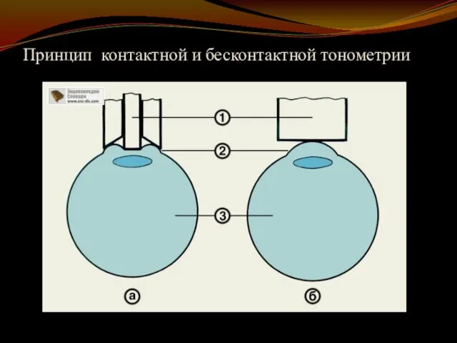 Принцип контактной и бесконтактной тонометрии