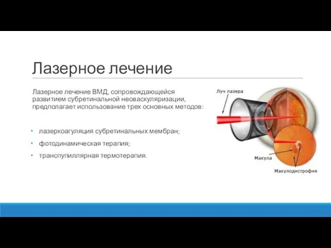 Лазерное лечение Лазерное лечение ВМД, сопровождающейся развитием субретинальной неоваскуляризации, предполагает