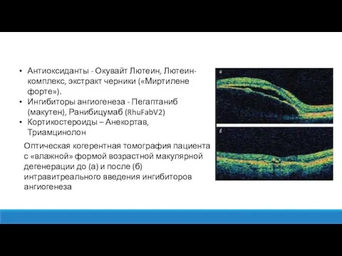 Антиоксиданты - Окувайт Лютеин, Лютеин-комплекс, экстракт черники («Миртилене форте»). Ингибиторы