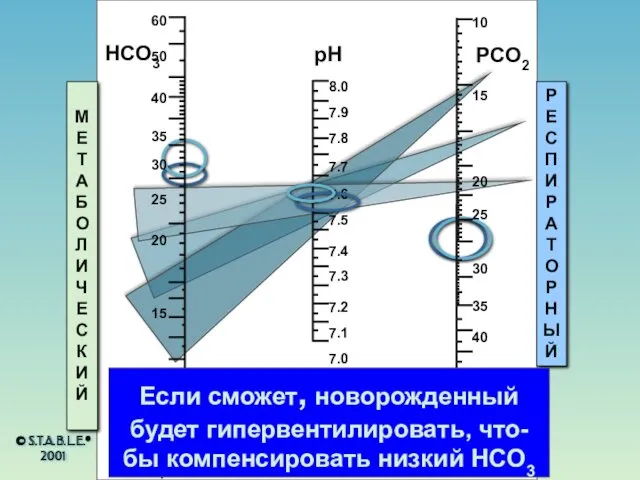 HCO3 pH PCO2 МЕТАБОЛИЧЕСКИЙ РЕСПИРАТОРНЫЙ Если сможет, новорожденный будет гипервентилировать,