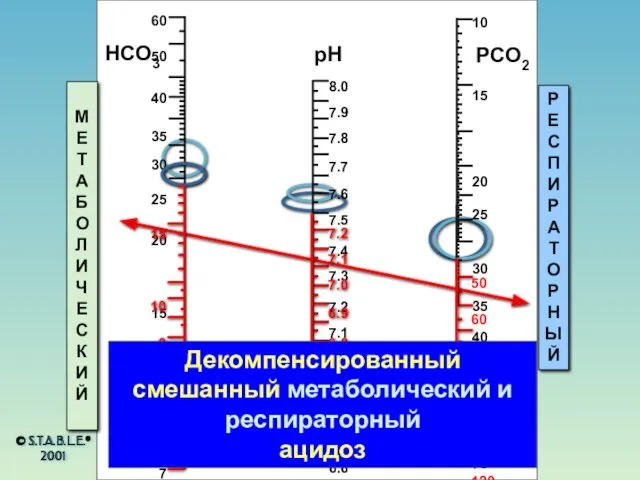 HCO3 pH PCO2 МЕТАБОЛИЧЕСКИЙ РЕСПИРАТОРНЫЙ Декомпенсированный смешанный метаболический и респираторный ацидоз © S.T.A.B.L.E.® 2001