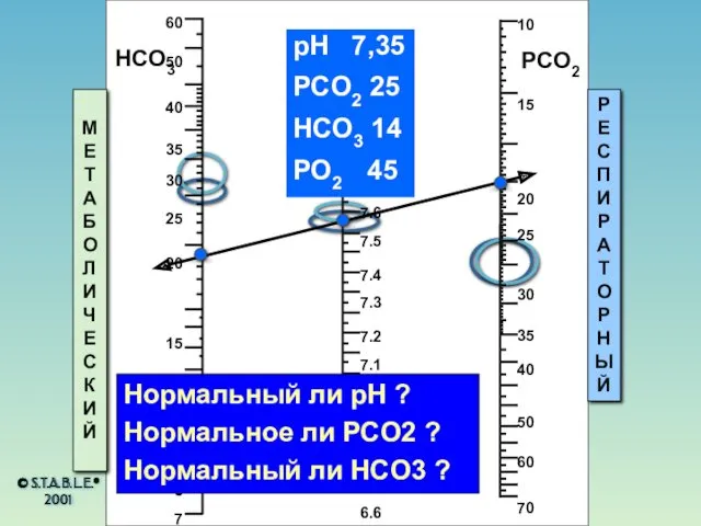 © S.T.A.B.L.E.® 2001 HCO3 pH PCO2 МЕТАБОЛИЧЕСКИЙ РЕСПИРАТОРНЫЙ pH 7,35