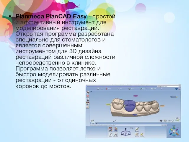 Planmeca PlanCAD Easy - простой и эффективный инструмент для моделирования