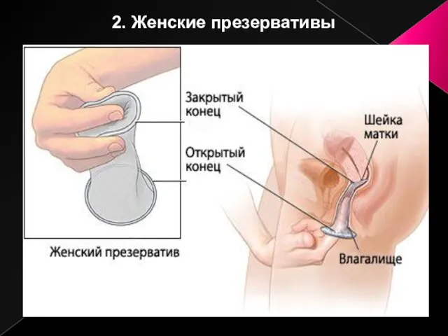 2. Женские презервативы