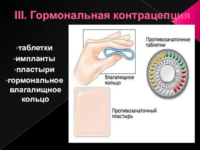 III. Гормональная контрацепция таблетки импланты пластыри гормональное влагалищное кольцо