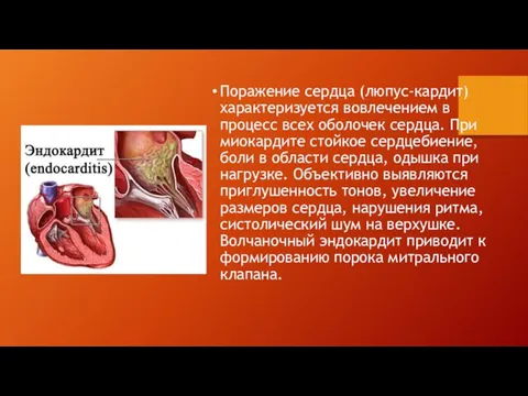 Поражение сердца (люпус-кардит) характеризуется вовлечением в процесс всех оболочек сердца.