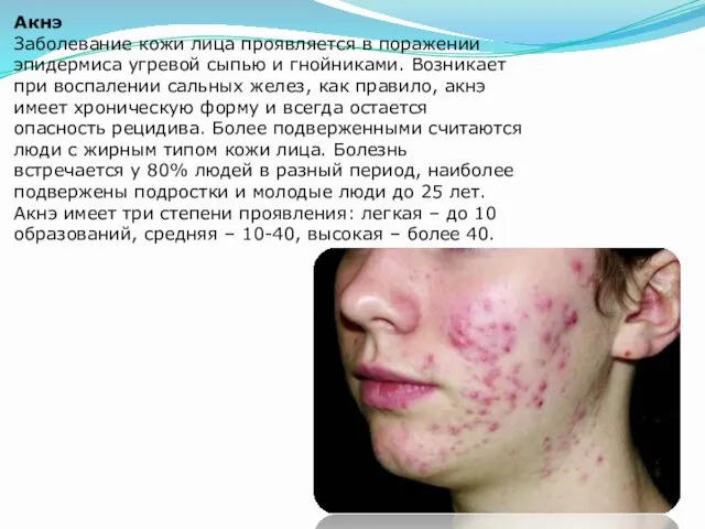 Акнэ Заболевание кожи лица проявляется в поражении эпидермиса угревой сыпью и гнойниками. Возникает