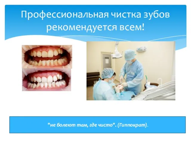 Профессиональная чистка зубов рекомендуется всем! "не болеют там, где чисто". (Гиппократ).