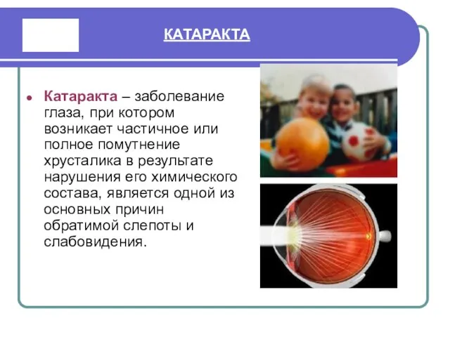 КАТАРАКТА Катаракта – заболевание глаза, при котором возникает частичное или