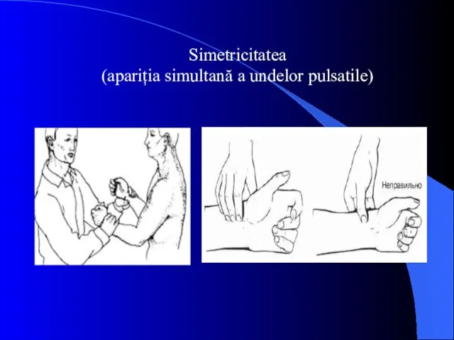 Simetricitatea (apariția simultană a undelor pulsatile)