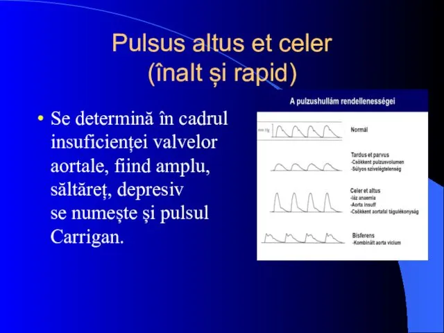 Pulsus altus et celer (înalt și rapid) Se determină în