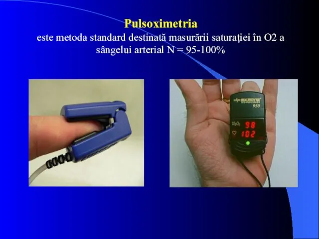 Pulsoximetria este metoda standard destinată masurării saturaţiei în O2 a sângelui arterial N = 95-100%