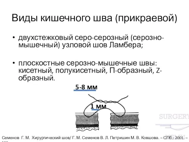 Виды кишечного шва (прикраевой) двухстежковый серо-серозный (серозно-мышечный) узловой шов Ламбера;