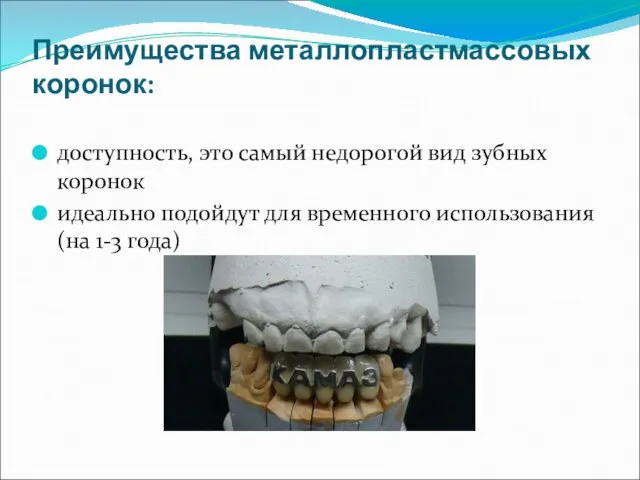 Преимущества металлопластмассовых коронок: доступность, это самый недорогой вид зубных коронок идеально подойдут для