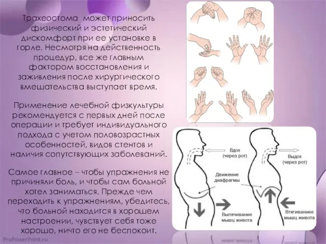 Трахеостома может приносить физический и эстетический дискомфорт при ее установке