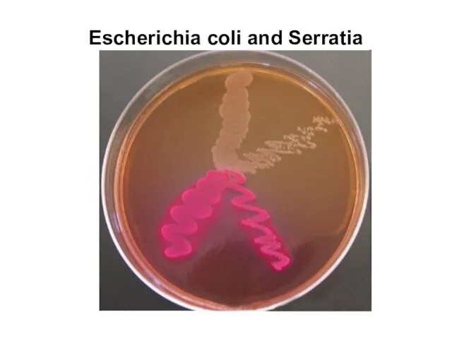 Escherichia coli and Serratia