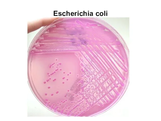 Escherichia coli