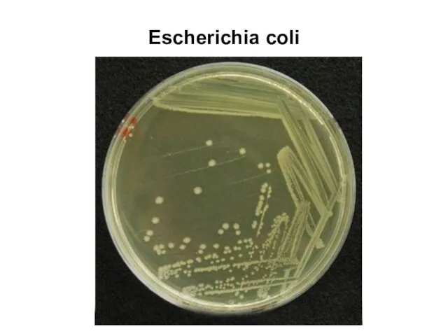 Escherichia coli