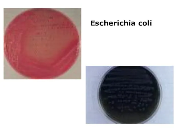 Escherichia coli