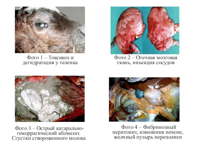 Фото 2 – Отечная мозговая ткань, инъекция сосудов Фото 3 – Острый катарально-геморрагический