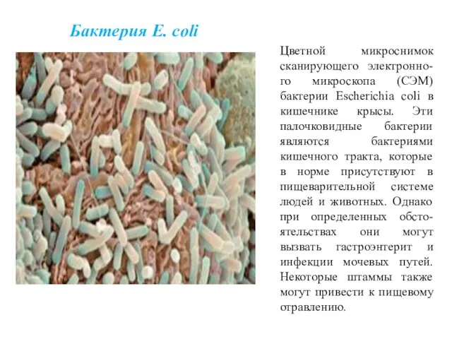 Бактерия E. coli Цветной микроснимок сканирующего электронно-го микроскопа (СЭМ) бактерии Escherichia coli в