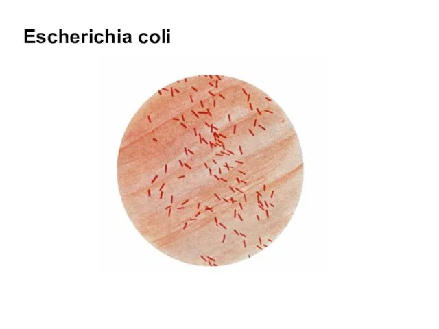 Escherichia coli