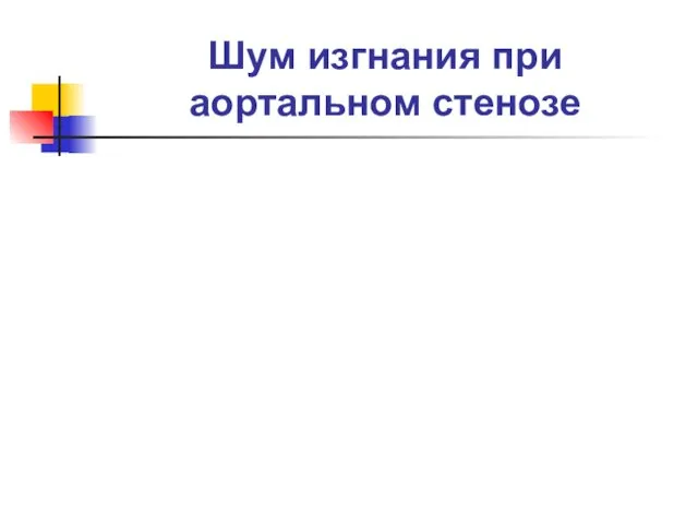 Шум изгнания при аортальном стенозе