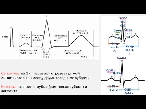 Сегментом на ЭКГ называют отрезок прямой линии (изолинии) между двумя