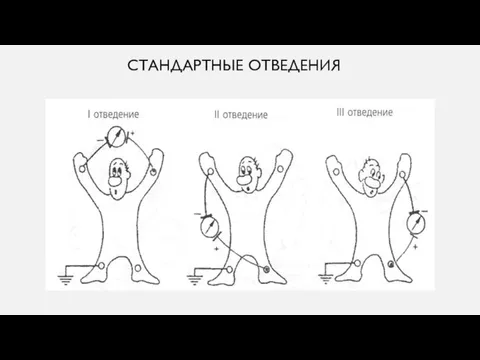 СТАНДАРТНЫЕ ОТВЕДЕНИЯ