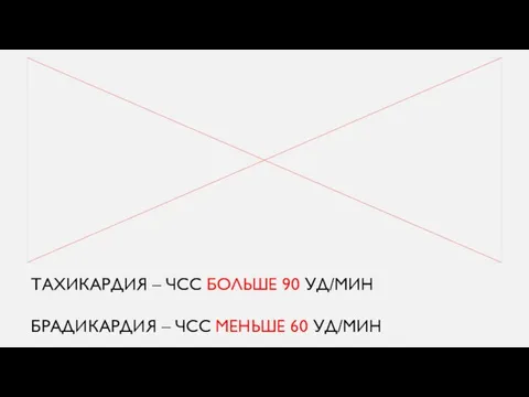 ТАХИКАРДИЯ – ЧСС БОЛЬШЕ 90 УД/МИН БРАДИКАРДИЯ – ЧСС МЕНЬШЕ 60 УД/МИН