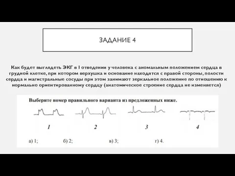 ЗАДАНИЕ 4 Как будет выглядеть ЭКГ в I отведении у