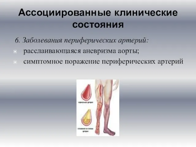 Ассоциированные клинические состояния 6. Заболевания периферических артерий: расслаивающаяся аневризма аорты; симптомное поражение периферических артерий