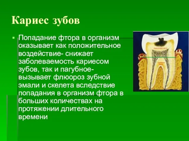 Кариес зубов Попадание фтора в организм оказывает как положительное воздействие-