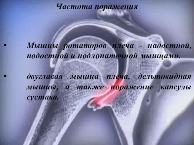 Мышцы ротаторов плеча - надостной, подостной и подлопаточной мышцами. двуглавая мышца плеча, дельтовидная