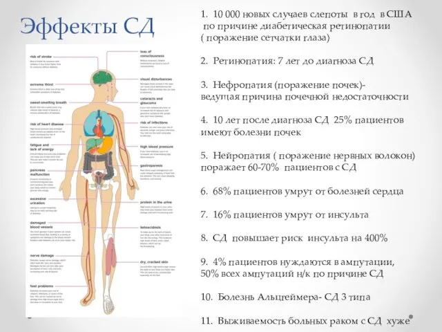 Эффекты СД 1. 10 000 новых случаев слепоты в год