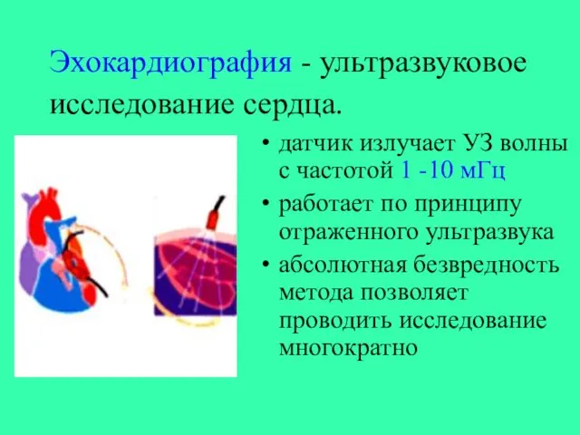 Эхокардиография - ультразвуковое исследование сердца. датчик излучает УЗ волны с