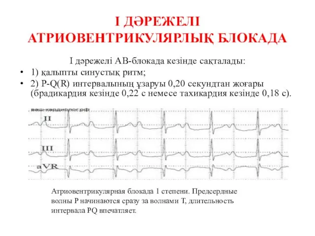 І ДӘРЕЖЕЛІ АТРИОВЕНТРИКУЛЯРЛЫҚ БЛОКАДА І дәрежелі АВ-блокада кезінде сақталады: 1)