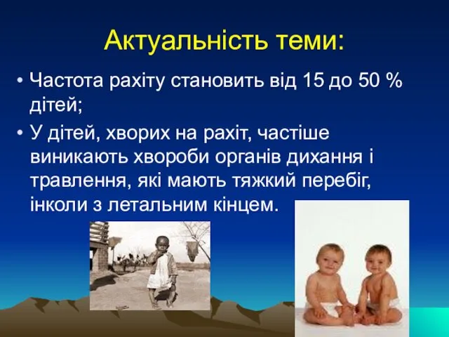 Актуальність теми: Частота рахіту становить від 15 до 50 %