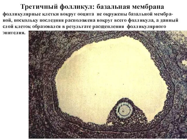 Третичный фолликул: базальная мембрана фолликулярные клетки вокруг ооцита не окружены базальной мембра-ной, поскольку