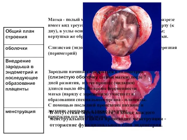Матка Матка - полый мышечный орган. На фронтальном разрезе имеет вид треугольника: его