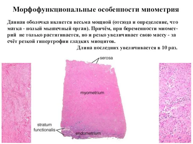 Морфофункциональные особенности миометрия Данная оболочка является весьма мощной (отсюда и