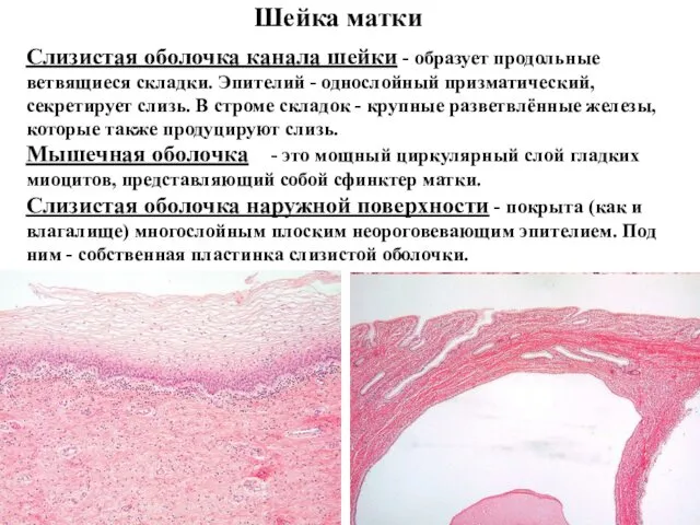 Шейка матки Слизистая оболочка канала шейки - образует продольные ветвящиеся