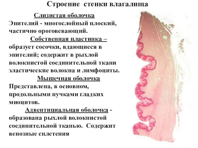 Строение стенки влагалища Слизистая оболочка Эпителий - многослойный плоский, частично