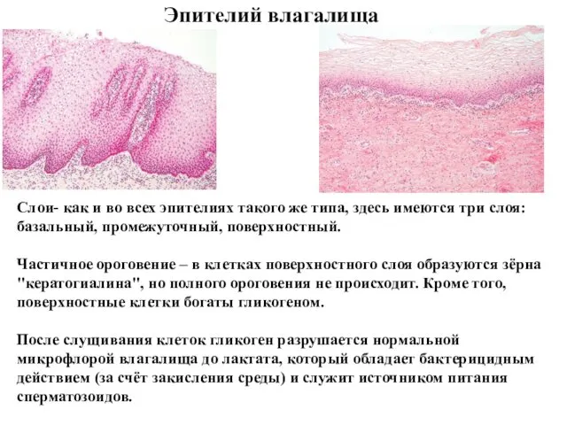 Эпителий влагалища Слои- как и во всех эпителиях такого же