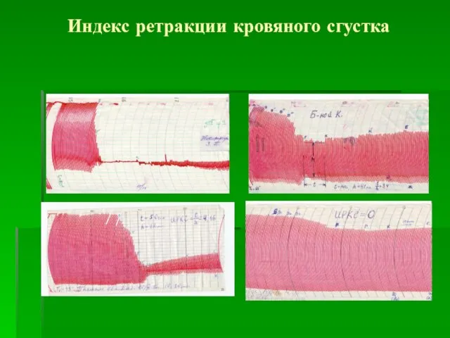 Индекс ретракции кровяного сгустка