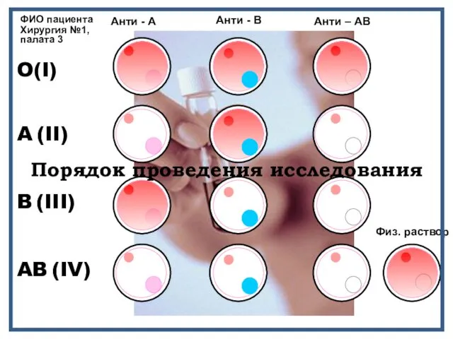 Анти - В Анти - А Анти – АВ O(I)