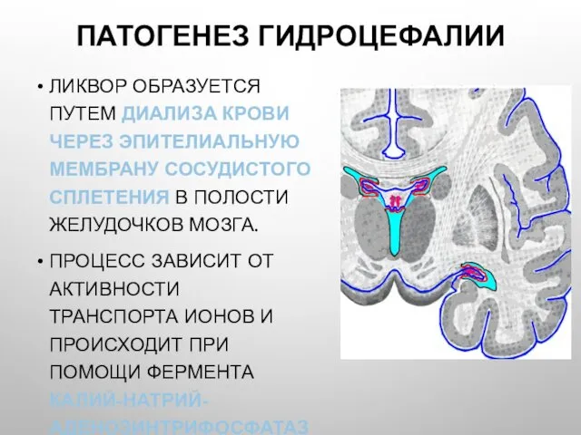 ПАТОГЕНЕЗ ГИДРОЦЕФАЛИИ ЛИКВОР ОБРАЗУЕТСЯ ПУТЕМ ДИАЛИЗА КРОВИ ЧЕРЕЗ ЭПИТЕЛИАЛЬНУЮ МЕМБРАНУ