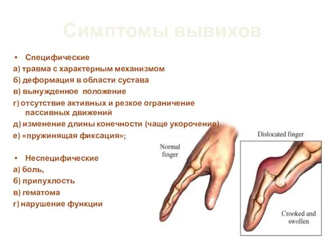 Симптомы вывихов Специфические а) травма с характерным механизмом б) деформация