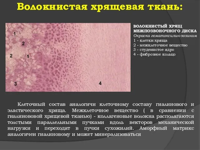 Волокнистая хрящевая ткань: Клеточный состав аналогичн клеточному составу гиалинового и