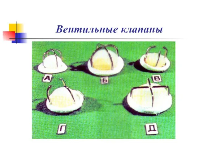 Вентильные клапаны